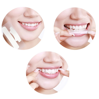 Smilumin – Σετ οδοντιατρικής φροντίδας με λάμπα LED και ταινίες